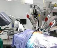 Première mondiale en chirurgie robotique : une auto-transplantation rénale