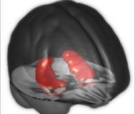 Vieillissement du cerveau : des modifications génétiques identifiées