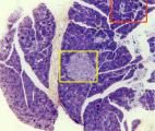 Cancer du pancréas : un  diagnostic précoce grâce à l' imagerie à fluorescence