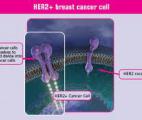 Cancer du sein métastasé : une trithérapie prometteuse