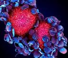 Propagation des cancers : cibler les plaquettes pour contrer les métastases