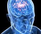 Un cerveau virtuel pour décrypter l'épilepsie